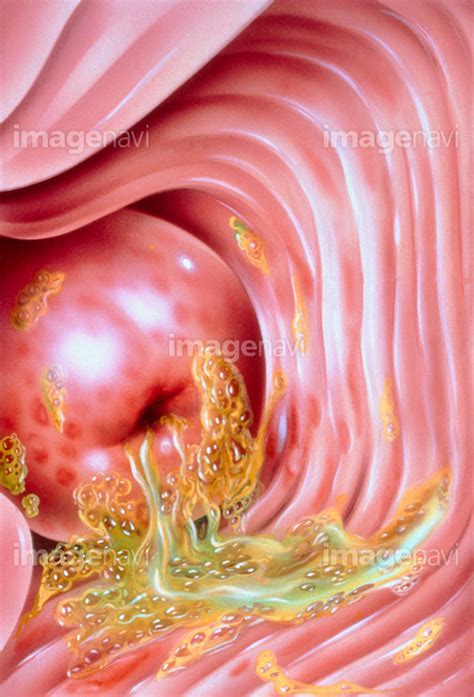 中出し 断面|【膣内断面図】 膣内で生ちんぽ受精中がしっかりと分かる断面。